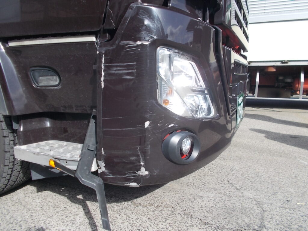 ロントボデーの衝撃吸収設計：衝突事故の損傷パターンと診断の鍵